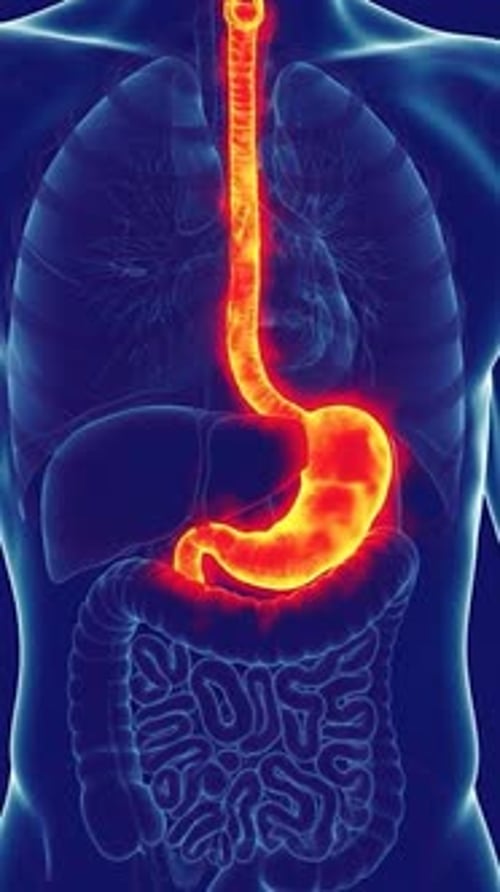 3D Medical Animation of Esophagus and Stomach Acid Reflux