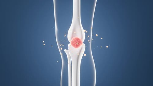 Knee Joint Medical Animation with Therapeutic Particle Flow