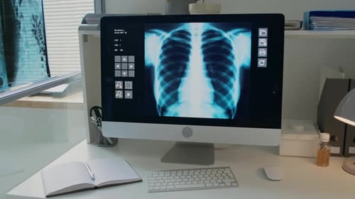 Tidy Desk in Medical Office with Computer Monitor Displaying Chest X-ray