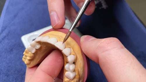 False Teeth Restoration at Dental Lab