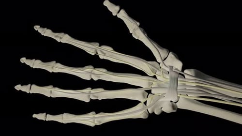Human hand anatomy showing carpal tunnel syndrome and nerve compression