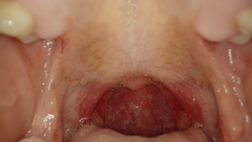 The man opens his mouth and the probe with the camera goes inside the mouth. Macro examination