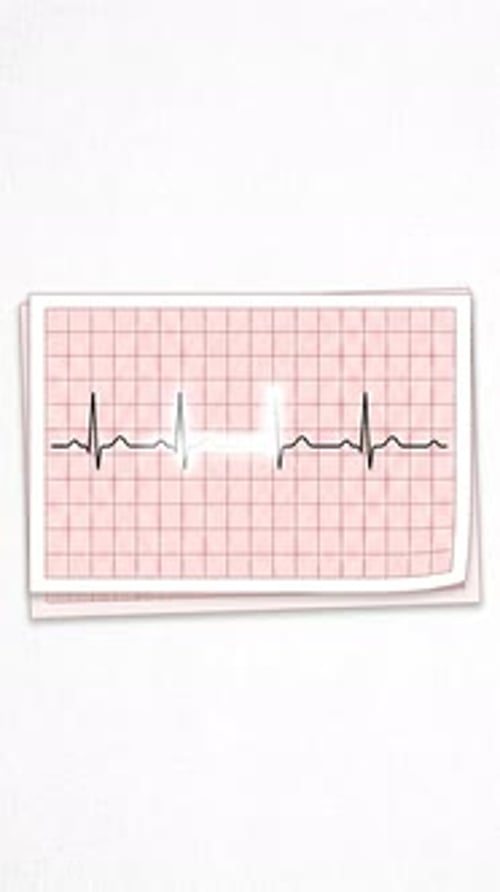 Animated ECG Heartbeat Pulse on Vertical Medical Graph