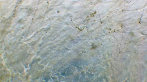 Nematode in Petri dish