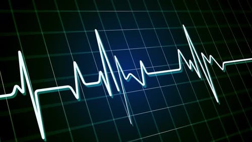 Animated Heartbeat Line on Digital Medical Monitor