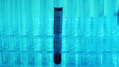 COVID-19 test tube sits in rack