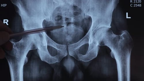El médico aprende a hacer una resonancia magnética de los huesos de la columna lumbar
