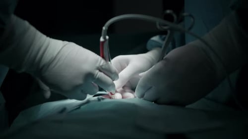 Nahaufnahme der Hände des Chirurgen bei der Durchführung einer Präzisionschirurgie im Operationssaal