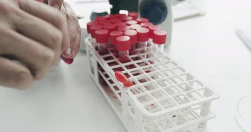 Envío de las muestras para su posterior análisis