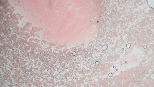 Fresh blood seen on a 400x microscope view. Blood smear under microscope present plasma