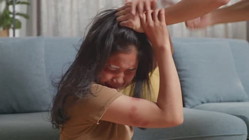 Young Asian Woman Victim Of Violence With Bruise On Body Abused By Man'S Hands Pulling Her Hair