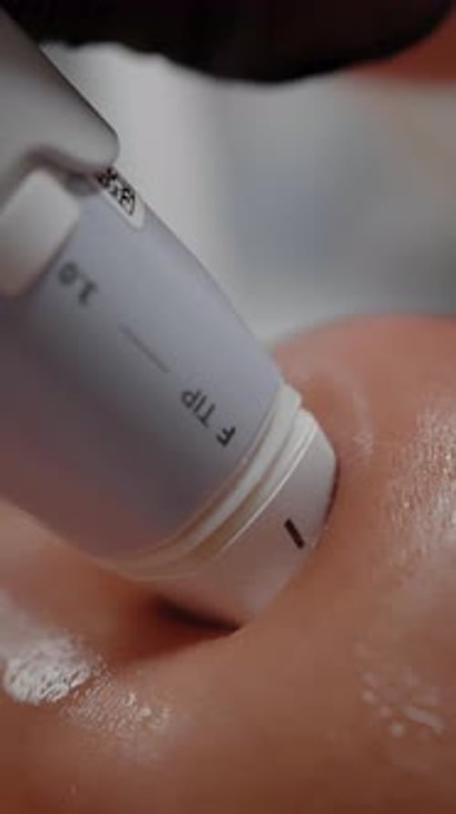 Ultrasound Applicator During Body Contouring Treatment