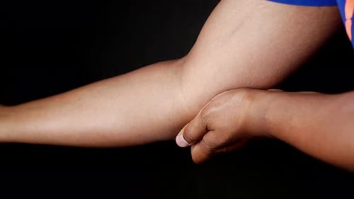Young Man Suffering Pain on Elbow