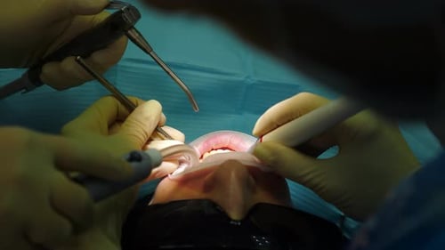 Dentist Performing Procedure with Tools on Patient's Teeth
