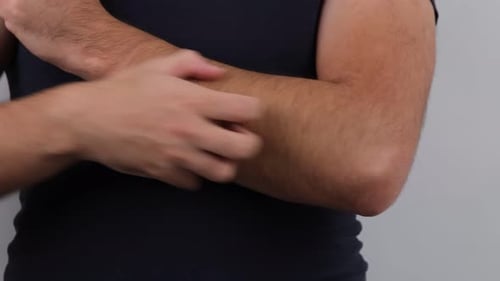 itching