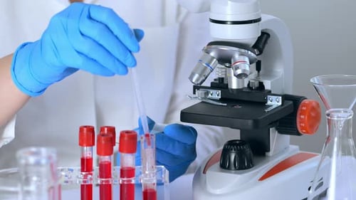 Blood Sample Preparation for Microscope Examination