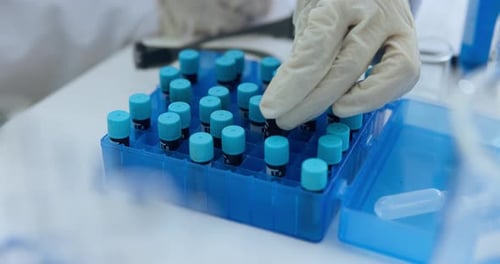 Medical, hands or person in clinic with blood sample, biology or dna investigation