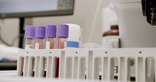 Blood Sample in Test Tubes in Laboratory