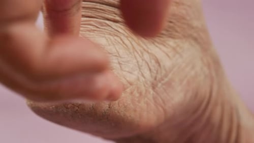 Applying Petroleum Jelly on Dry Feet