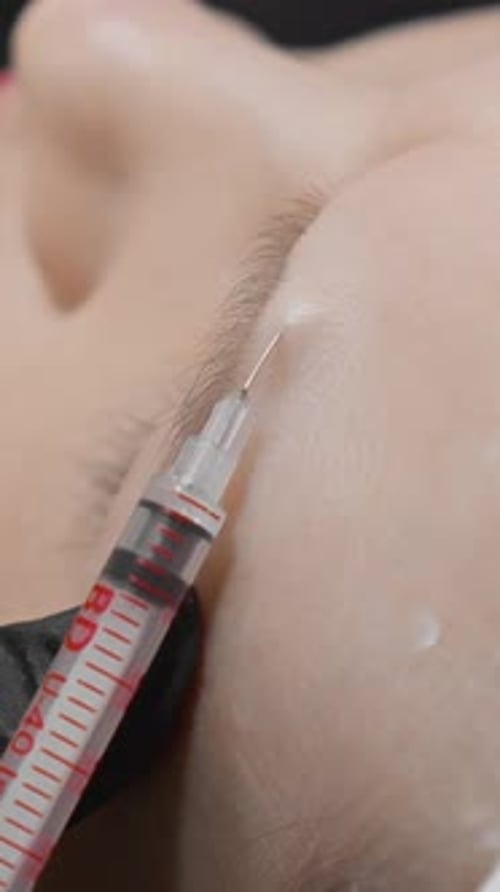 Cosmetic Injection Procedure on Face Close Up