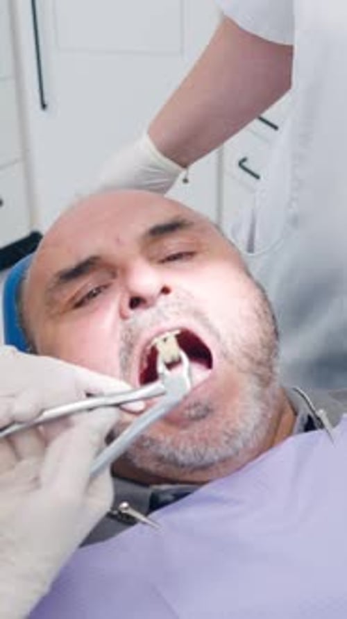 Dentist Performing Tooth Extraction on Middleaged Man Vertical
