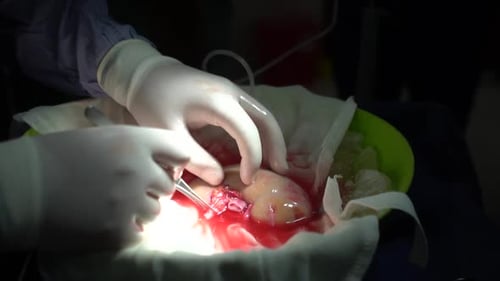 Niere zur Organtransplantation