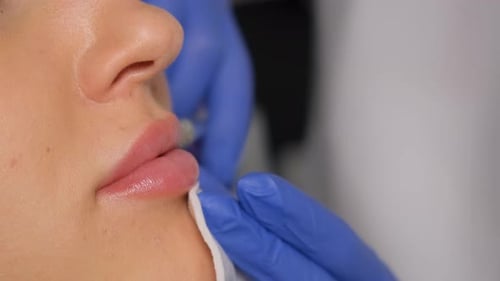 Una cosmetóloga hace inyecciones en los labios de una hermosa niña Procedimiento de aumento de labios