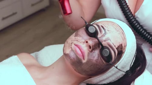 Woman Receiving Carbon Peel Laser Facial Treatment