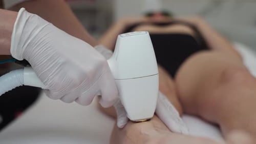 Beautician Performing Laser Hair Removal on Woman Legs in a Professional Clinic