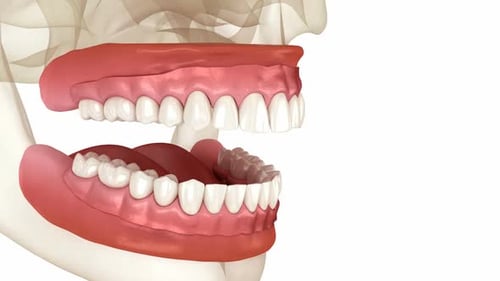 Prothèse amovible, gencive et dents artificielles
