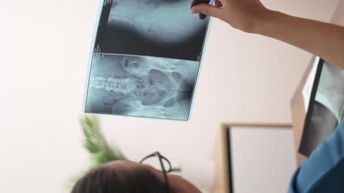 Doctor Studies Radiology Xray Film Healthcare Services and Patient Diagnosis in the Hospital