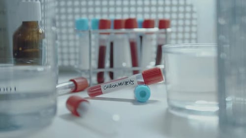 Blood Sample in Lab for Coronavirus Research