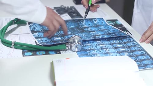 Doctors Are Studying With A Brain Diagram In The Office