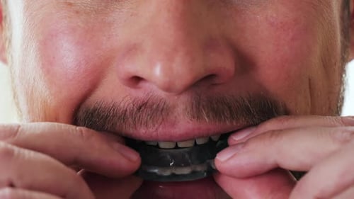 The Man Puts the Mouth Guard Close Up Footage Dental Trainer for Adults for the Treatment of