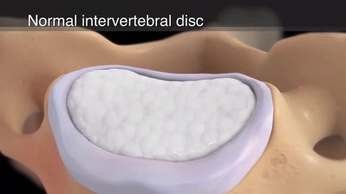 Normal Intervertebral Disc Anatomy 3D Animation