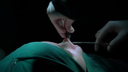 Rhinoplasty procedure and stitching doctor, end of operation.. Rhinoplasty procedure performed by a