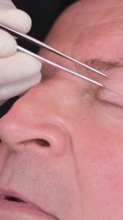 Closeup Examination of the Face of an Old Man Before Plastic Surgery to Change the Eye Area