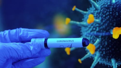 Close up of doctor hand holding positive coronavirus blood test in medical lab