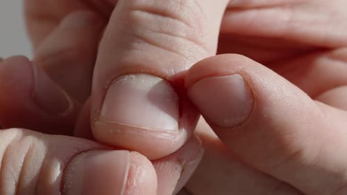 A Man Tore the Cuticle on His Finger, and Blood Started. Close-Up.