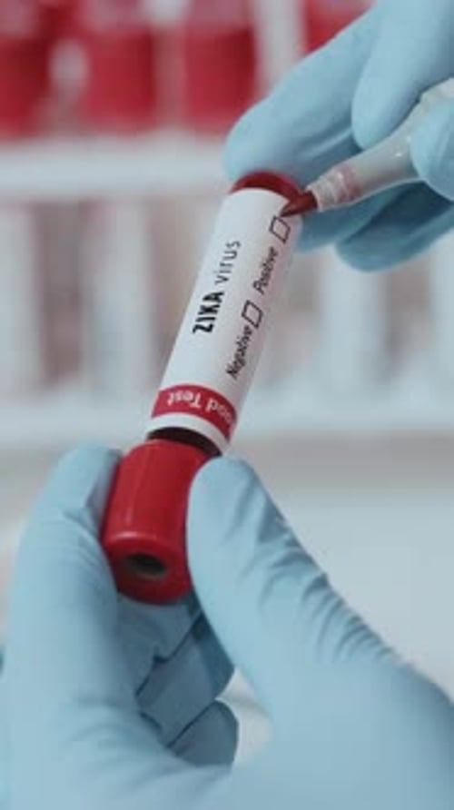 Healthcare Professional Analyzing Zika Virus Blood Test Results in Clinic