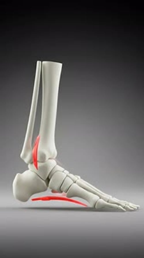 Foot Foundation Collapse - Fallen Arches Pes Planus 3D Medical Animation | Manestream Den