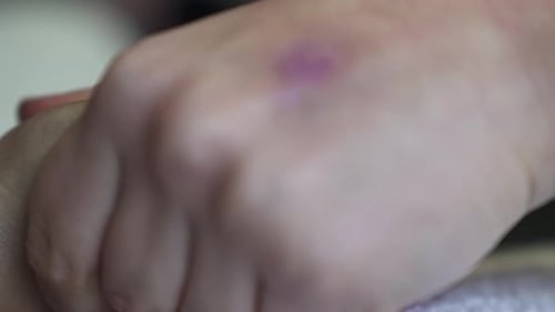 Erleben Sie die Glückseligkeit einer Handmassage, die ganzheitliche Entspannung und Wohlbefinden bietet. Unser Ski