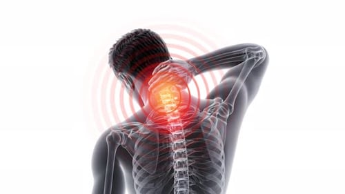 3D Human Shoulder Anatomy Neck Pain Highlight