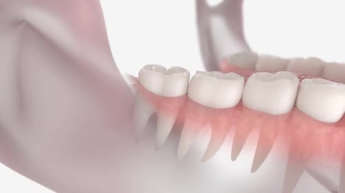 3D Animated Tooth Extraction in Human Jaw Medical Procedure