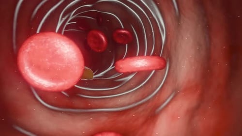 Blood Cells And Plaque Flowing Through Artery Animation