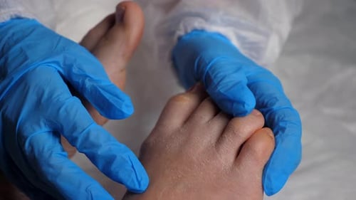 Doctor Examines Patient's Foot in Clinic
