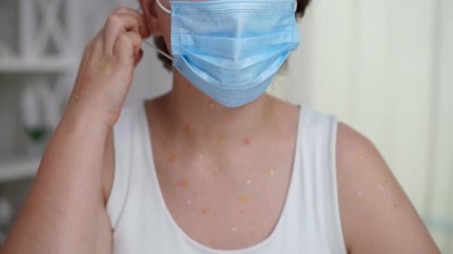Woman Takes off Surgical Mask Showing Face Spots