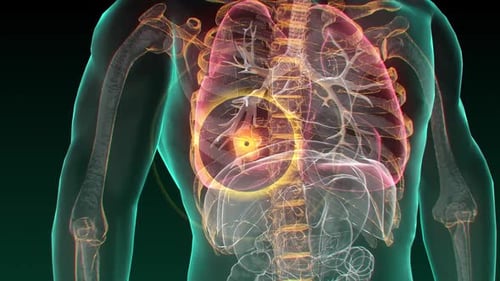 Animated Human Torso with Highlighted Lungs for Medical Diagnosis
