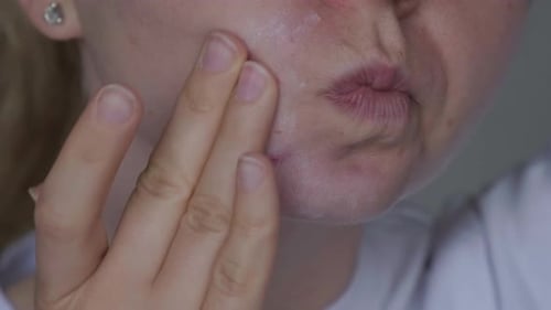 Unrecognizable Woman Applies Makeup Cream Serum Cure for Acne on Face