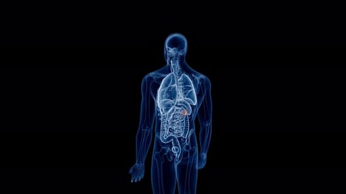 Animated human kidney tumor showing cancer growth in medical scan